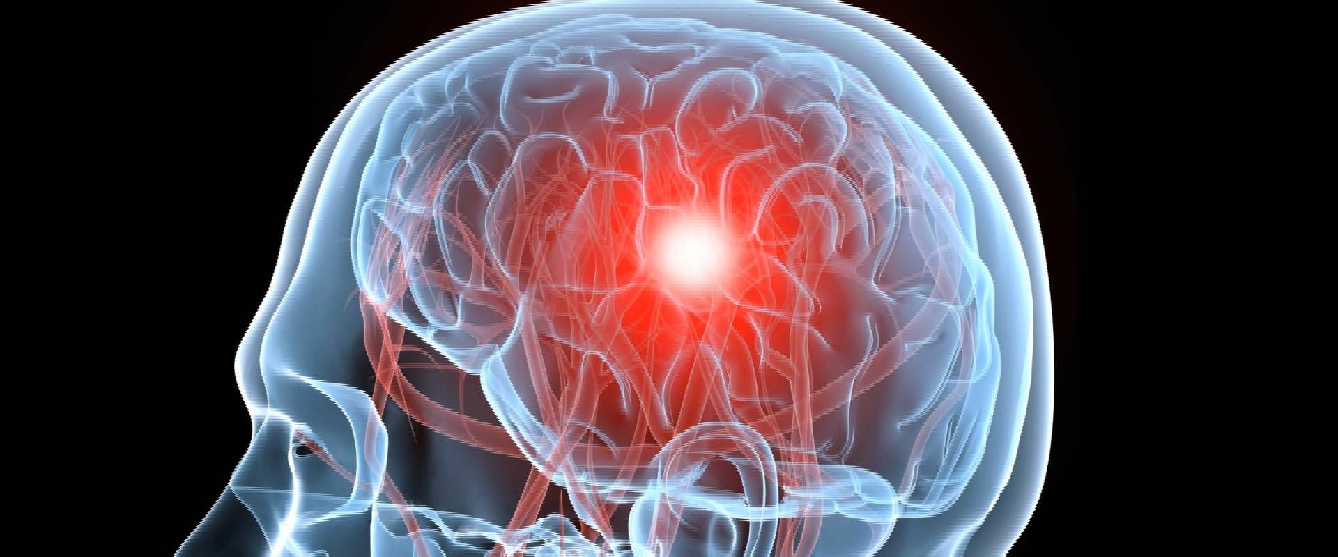 The Long-Term Effects of Brain Injuries: What You Need to Know