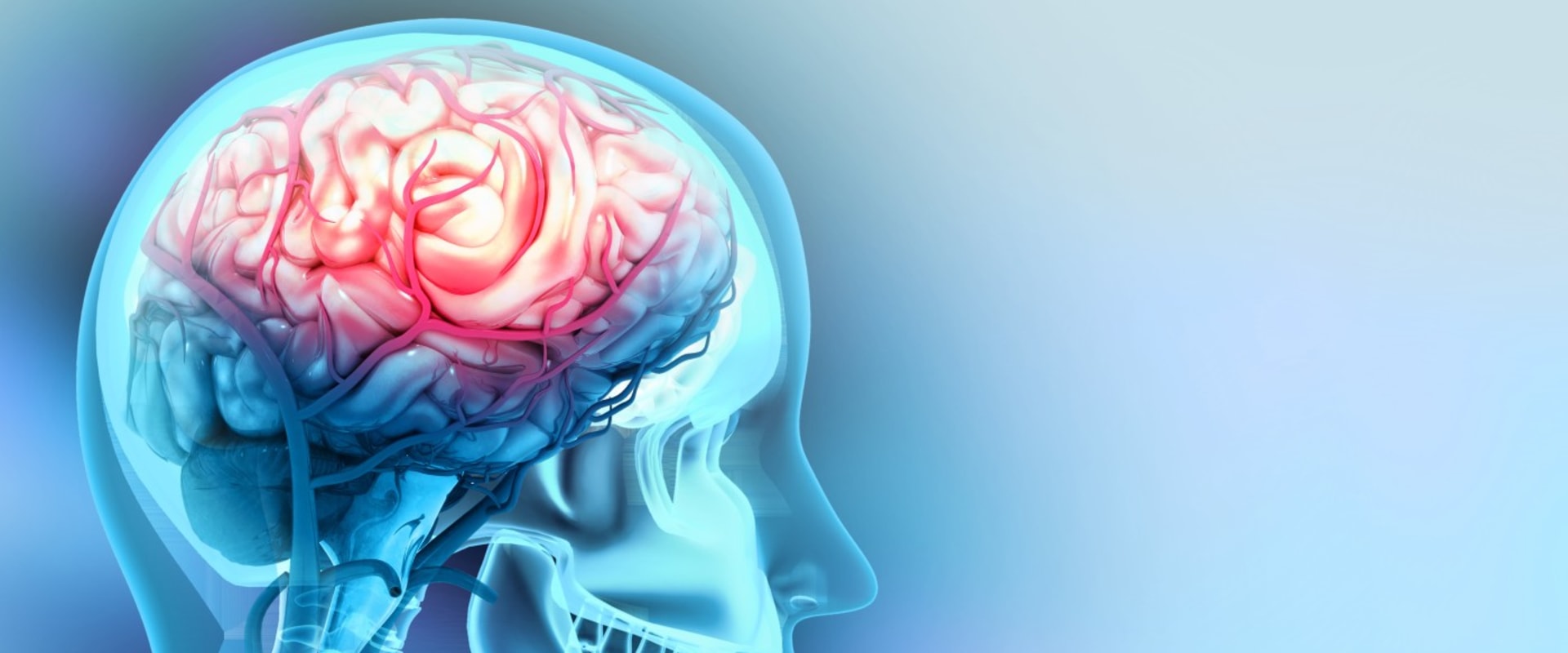 The Impact of Traumatic Brain Injury on Life Expectancy