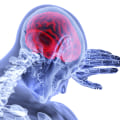 The Impact of Traumatic Brain Injury on Everyday Life