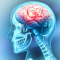 The Impact of Traumatic Brain Injury on Life Expectancy