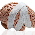 Coping with Traumatic Brain Injury: Tips from an Expert