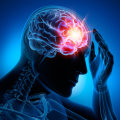 The Long-Term Effects of Traumatic Brain Injury