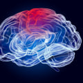 Understanding the Long-Term Effects of Acquired Brain Injuries