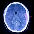 Understanding the Severity of Brain Injuries