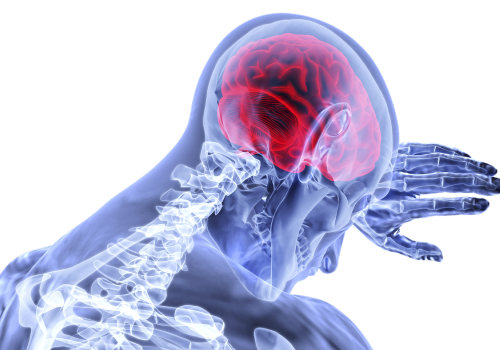 The Impact of Traumatic Brain Injury on Everyday Life