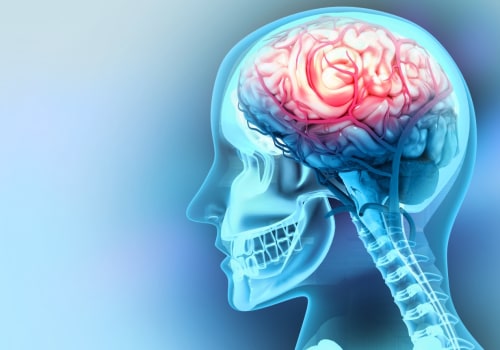 The Impact of Traumatic Brain Injury on Life Expectancy