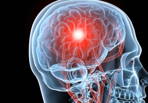 The Long-Term Effects of Brain Injuries: What You Need to Know